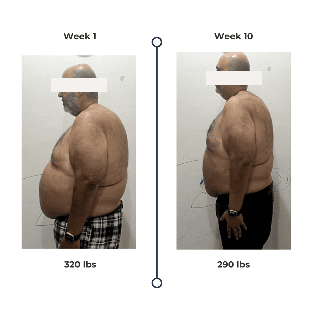 Transformation post (2)